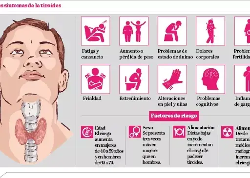 Síntomas de tiroides en mujeres: ¿Reconoces las señales clave?