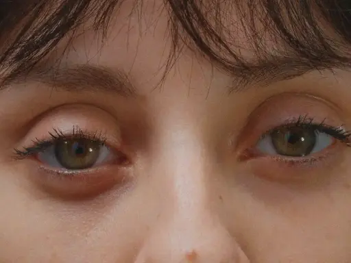 Gros plan sur des yeux verts, l'un d'eux présente une poche sous l'œil gonflée, signe d'une nuit agitée.