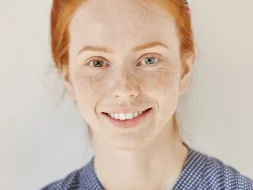 Ruda dziewczyna z piegami i różnymi kolorami oczu – przykład heterochromii.