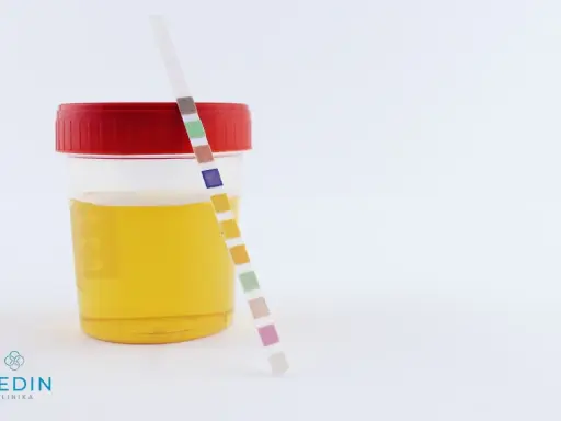Pojemnik z żółtym płynem i paskiem testowym do analizy moczu. Kolory na pasku mogą wskazywać na różne parametry, w tym na ciemny mocz.