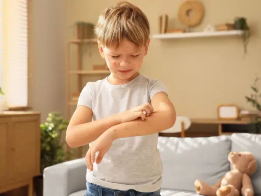 Niño con varicela en brazos y cara, rascándose el brazo.