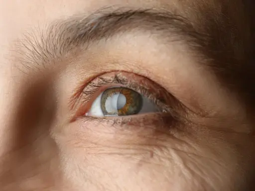 Gros plan sur un œil humain, montrant des rides autour de l'œil et une légère perte de cils.