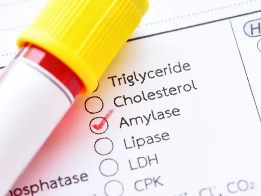 Esame del sangue con provetta e modulo di analisi. La casella "Amylase" è spuntata, indicando un controllo dei valori normali di amilasi.