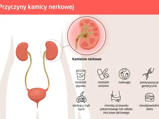 Kolka nerkowa: objawy, ból nie do zniesienia? Kiedy pilnie do szpitala?