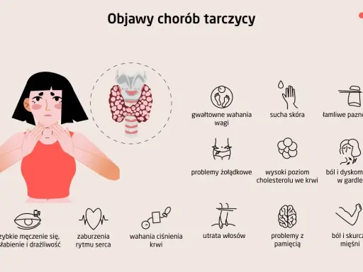 Czy tarczyca może boleć? Grafika pokazuje objawy chorób tarczycy: zmęczenie, problemy z wagą, skórą, paznokciami, żołądkiem, sercem, pamięcią i bóle.