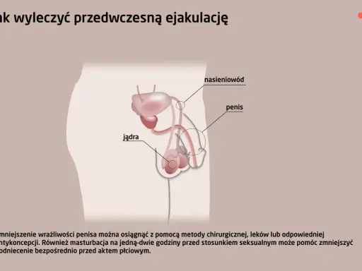 Ilustracja układu rozrodczego męskiego, omawiająca metody leczenia problemów z wytryskiem, w tym zmniejszenie wrażliwości penisa.