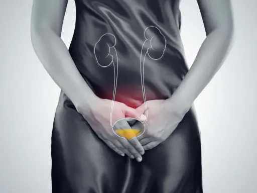 Kobieta z bólem w podbrzuszu, wskazującym na choroby pęcherza moczowego. Grafika przedstawia układ moczowy.