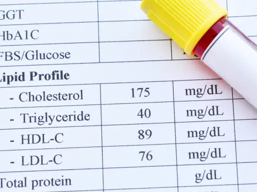 Fragment analizy lipidowej z wynikami cholesterolu, trójglicerydów, HDL-C i LDL-C oraz probówką krwi.
