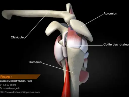 Anatomie de l'épaule montrant la clavicule, l'humérus et la coiffe des rotateurs. Une rupture de la coiffe des rotateurs peut être une maladie professionnelle.