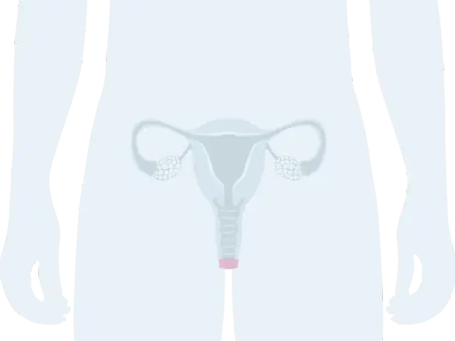 Illustration av kvinnliga könsorgan. En illustration som visar livmoder, äggledare och äggstockar. Ibland kan man uppleva luft ur underlivet.