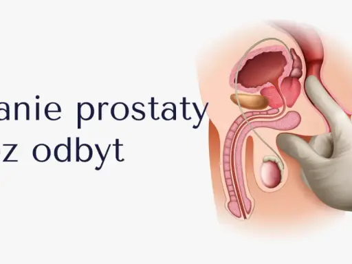 Ilustracja przedstawia badanie per rectum. Palec w rękawiczce bada prostatę, która może być wyczuwalna jako twarda.
