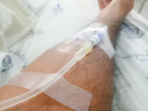 Ręka z założonym cewnikiem dializacyjnym, widoczna jest taśma medyczna i fragment pościeli szpitalnej. Pielęgnacja cewnika dializacyjnego jest kluczowa.