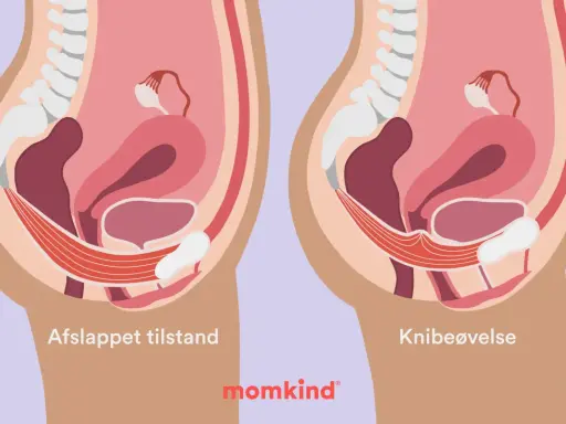 Illustration visar bäckenbotten i avslappnat och kontraherat läge. Träning kan hjälpa mot foglossning blygdbenet.