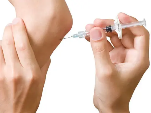 Eine Spritze wird an einem Ellbogen angesetzt. Dies ist ein Schritt in der biologika therapie zur Behandlung von Entzündungen.