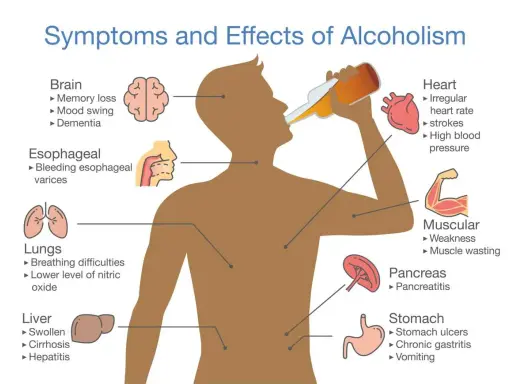 Ilustracja pokazuje, że alkohol to trucizna, która wpływa na mózg, serce, płuca, wątrobę, trzustkę i żołądek, powodując różne schorzenia.