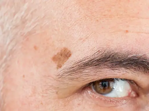 Gros plan sur le coin de l'œil d'une personne âgée, montrant des taches de vieillesse sur la peau et des sourcils poivre et sel.