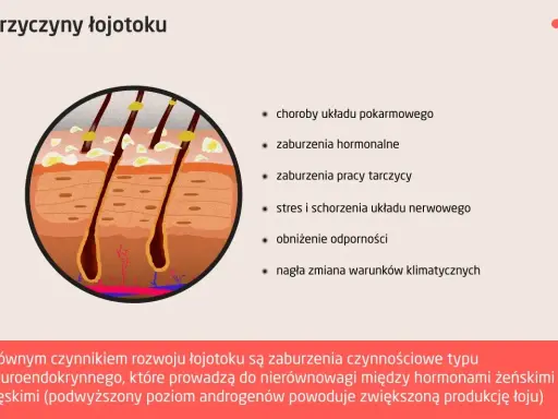Przekrój skóry z widocznymi gruczołami łojowymi, które mogą powodować rany na skórze głowy z powodu łojotoku.