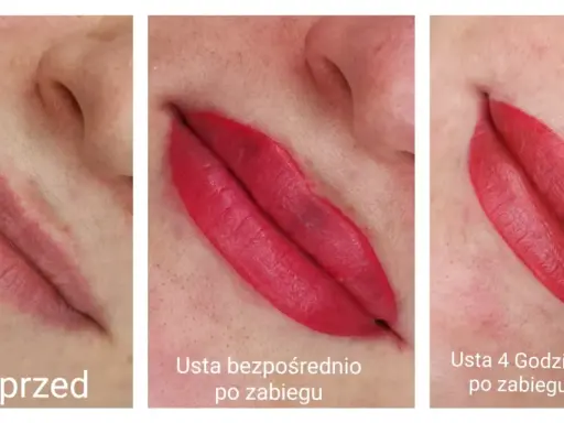 Makijaż permanentny ust: Gojenie dzień po dniu. Co Cię czeka?