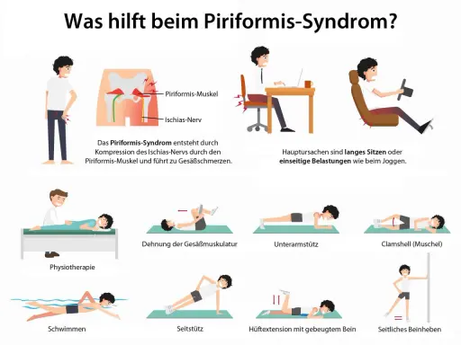 Illustrationen zeigen Übungen zur Linderung des Piriformis-Syndroms, wie Dehnung, Physiotherapie und Schwimmen. So kannst du den Piriformis trainieren.