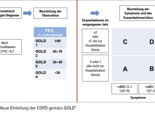 Schema zur Einteilung der COPD-Stadien nach GOLD, basierend auf Obstruktion, Exazerbationen und Symptomen.