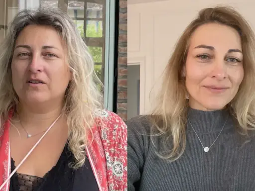 Avant/après : le visage s'affine visiblement après une perte de poids. La question "à partir de combien de kilos perd on du visage" trouve ici une réponse visuelle.