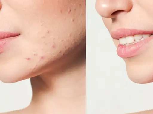 Twoja cera marzeń: Jak poprawić wygląd od diety po retinol?