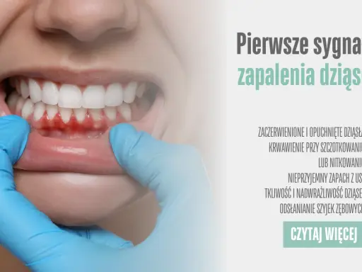 Zapalenie dziąseł: 7 objawów, których nie wolno ignorować!