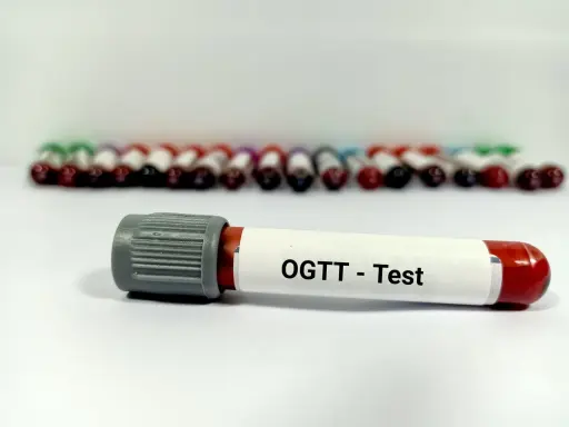 Probówka z oznaczeniem "OGTT - Test" na tle wielu innych próbek krwi. To ważny etap w diagnostyce cukrzycy, czyli test obciążenia glukozą.
