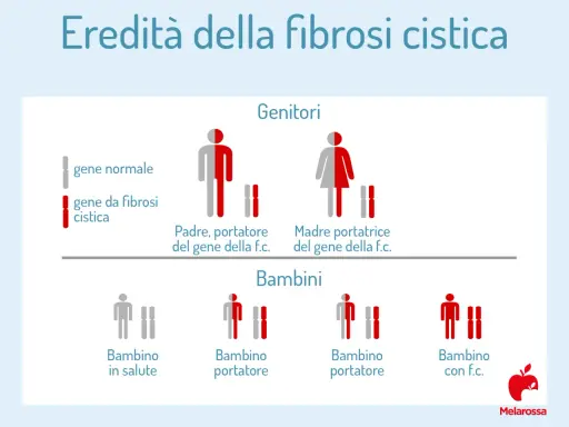 Schema sull'eredità della fibrosi cistica. Mostra genitori portatori sani e i possibili esiti per i bambini, inclusa la fibrosi cistica atipica.