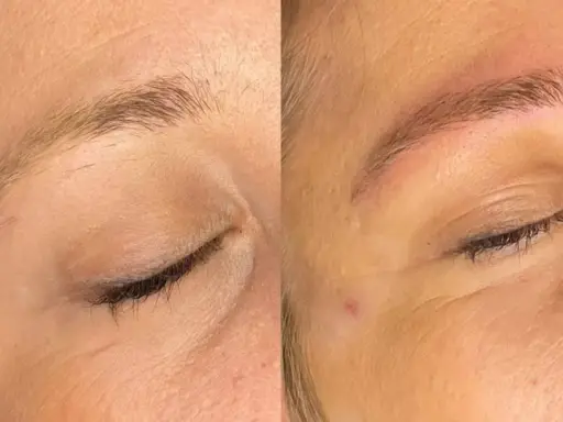 Avant/après d'un **tatouage sourcil** : les sourcils sont plus définis et remplis, offrant un regard plus intense.