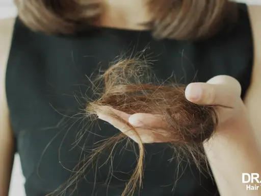 Une femme de 40 ans examine une poignée de cheveux tombés, signe de perte de cheveux.