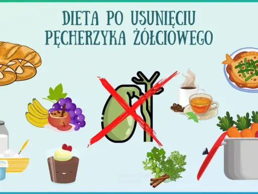 Zdrowe jedzenie po usunięciu woreczka żółciowego: pieczywo, owoce, nabiał, ryba, warzywa. Unikaj kawy i słodkości.
