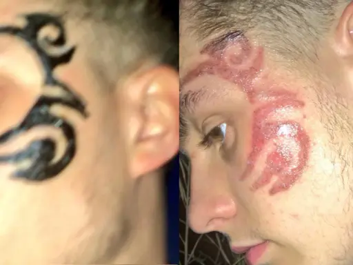 Henna do brwi jako tatuaż? Ryzykujesz zdrowie i blizny!