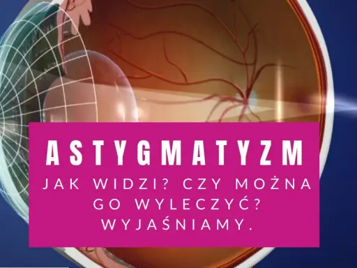 Astygmatyzm: jak widzi oko? Czy można go wyleczyć? Wyjaśniamy. Wizyta u okulisty lub optometrysty pomoże.