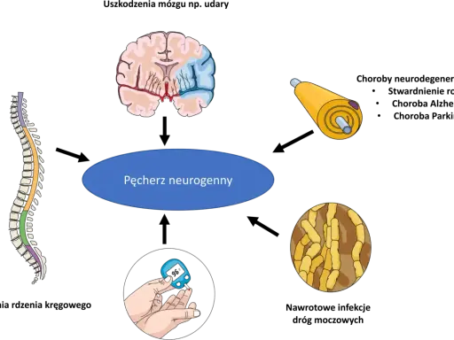 Ilustracja przedstawia mózg, rdzeń kręgowy, neuron i glukometr, które mogą wpływać na pęcherz neurogenny. Ćwiczenia na pęcherz neurogenny są kluczowe.