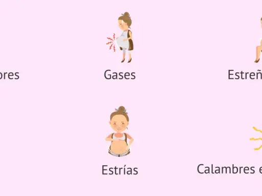Ilustraciones de síntomas comunes del embarazo: reflujo, gases, estreñimiento, cloasma, estrías y calambres en las piernas. Semana 25.