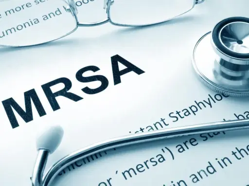 Documento con la scritta MRSA, stetoscopio e occhiali. Il batterio MRSA è una preoccupazione medica.