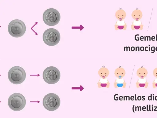 Ilustración muestra cómo un espermatozoide fecunda un óvulo, dando lugar a gemelos monocigóticos o dicigóticos. Tener gemelos depende del hombre o de la mujer.