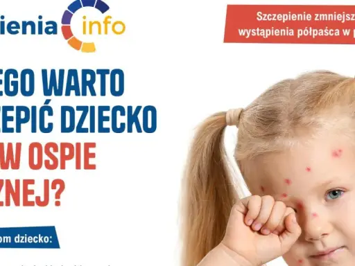 Dziewczynka z ospą wietrzną. Kampania informacyjna o szczepionce na ospę, podkreślająca jej znaczenie dla zdrowia dziecka.