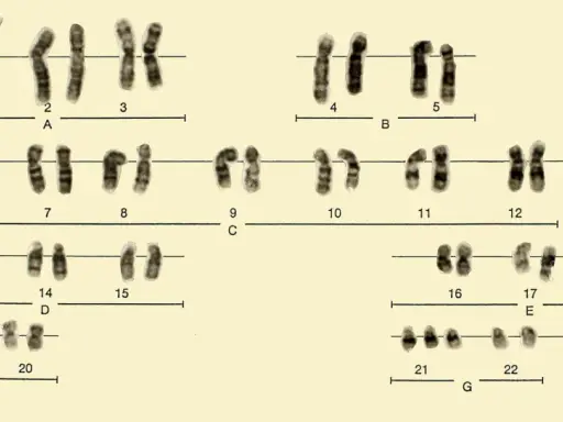 Cariotipo masculino con cromosomas ordenados por tamaño y forma, incluyendo los cromosomas sexuales X e Y.