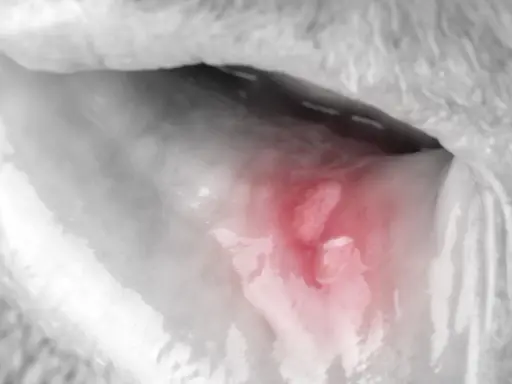 Afta i dentysta: Kiedy wizyta jest konieczna, a kiedy poczekać?