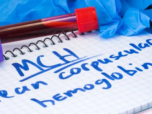 Notatnik z zapisanym "MCH mean corpuscular hemoglobin", probówki z krwią, rękawiczki i stetoskop. MCH podwyższone może wskazywać na pewne schorzenia.