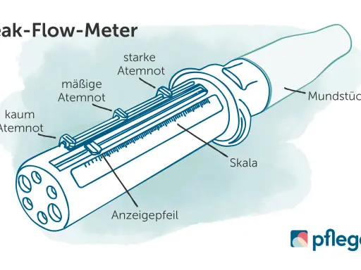 Ein Peak-Flow-Meter mit Skala und Anzeige. Es hilft, Atemnot bei COPD GOLD 3 zu messen.
