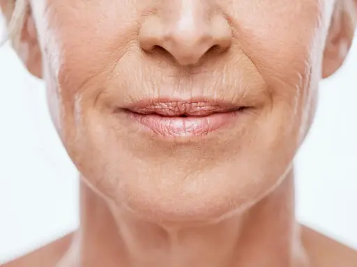 Gros plan sur le visage d'une femme, montrant les rides et ridules qui témoignent du vieillissement de la peau.