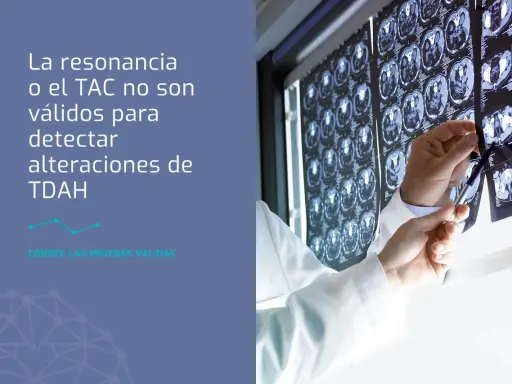 Médico revisa TACs cerebrales. La resonancia o TAC no detectan TDAH. Descubre qué puede estudiar un adolescente con TDAH.