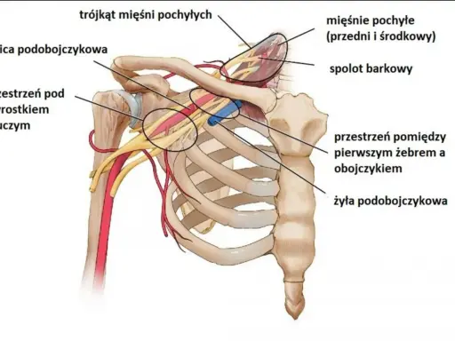 Anatomia górnego otworu klatki piersiowej: tętnica i żyła podobojczykowa, mięśnie pochyłe, splot barkowy.