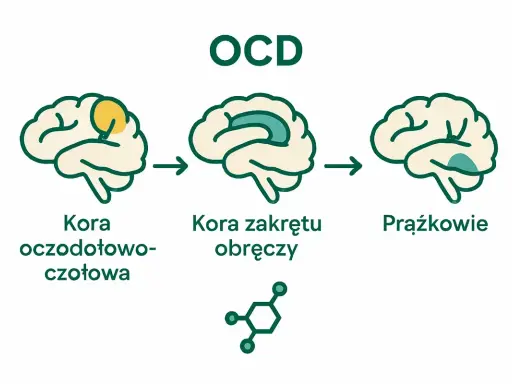 Ilustracja pokazuje, co to jest OCD: zmiany w korze mózgowej, w tym kora oczodołowo-czołowa i kora zakrętu obręczy, oraz prążkowia.