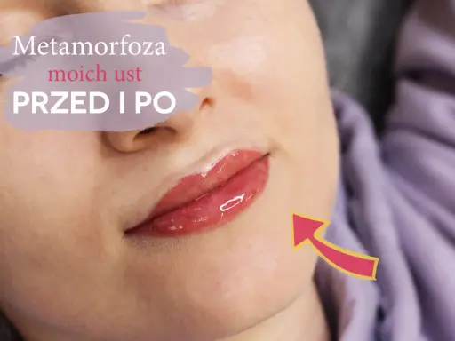 Metamorfoza moich ust przed i po. Czy makijaż permanentny ust boli? Zobacz efekt!