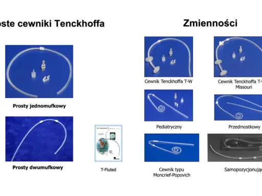 Różne rodzaje dializ: cewniki Tenckhoffa proste (jednomufkowe, dwumufkowe) i zmienne (T-W, pediatryczny, przedmostkowy, Moncrief-Popovich, samopozycjonujący).