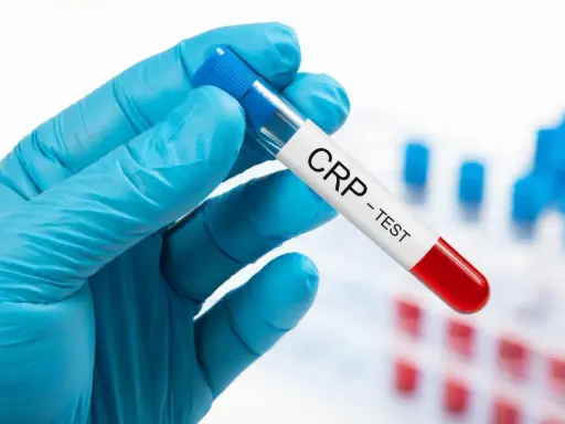Ręka w niebieskiej rękawiczce trzyma probówkę z napisem "CRP - TEST". Badanie CRP pomaga ocenić stan zapalny w organizmie.